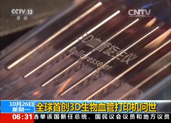国产全球首台3D血管打印机:2分钟造10厘米血管