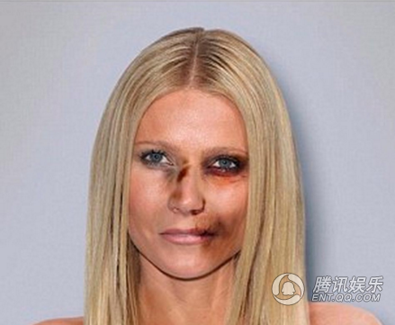 反对家庭暴力:鼻青脸肿的好莱坞女星见过吗?(图)