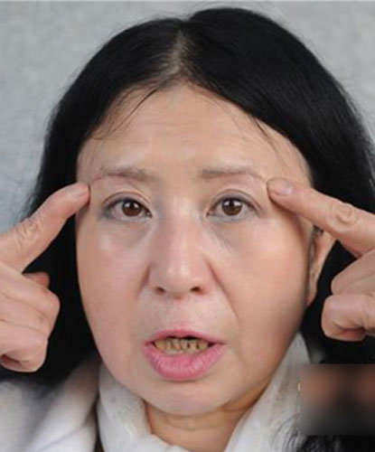 中年女子整容惨变50岁大妈 美容院:天生面相老