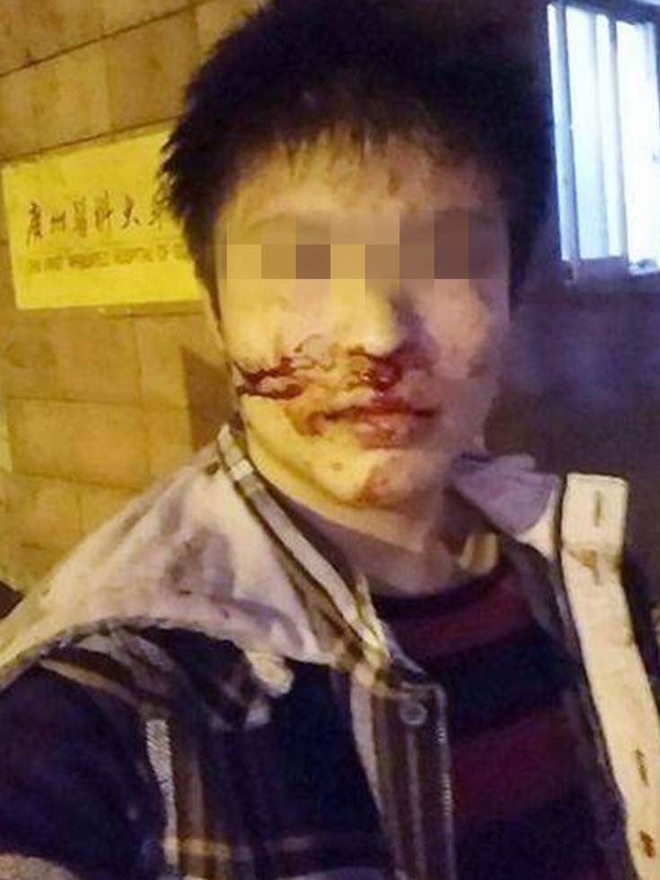 香港网红挺占中 自曝在广州遭伏击(图)