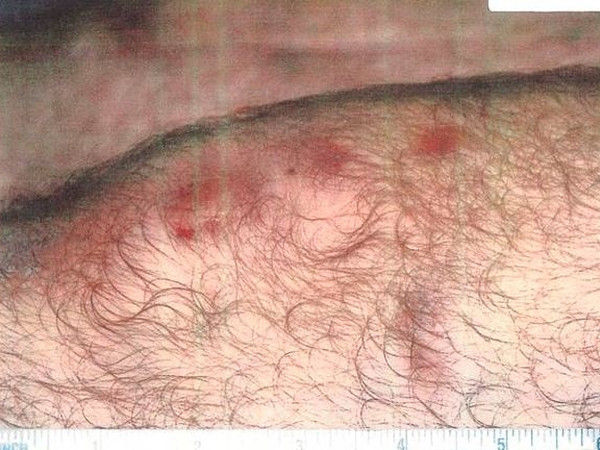 避重就轻！美拖延十几年才公开虐囚照(慎入/组图)