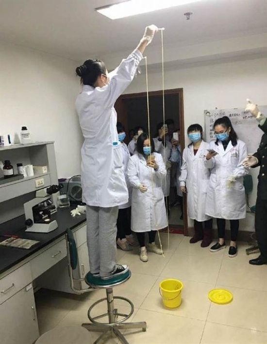 爱吃生肉!男子体内取出5米长寄生虫(图/慎入)