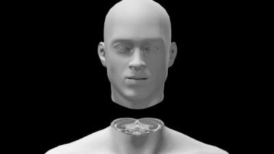 中国人首尝"换头术"? 中国专家:现在谈都是闲扯