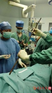 惨！男子高处坠落 一根钢筋从阴部贯穿到头顶