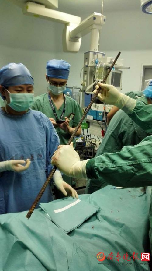 惨!男子高处坠落 一根钢筋从阴部贯穿到头顶