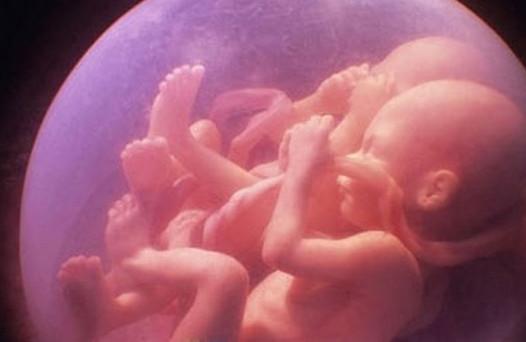 奇闻! 女子生下双胞胎竟然有两个父亲(图)