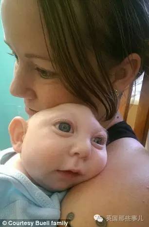 她的每一天都是奇迹:这个宝宝出生就少半个脑袋