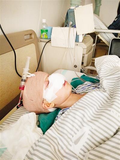 重庆:男子复婚被拒 一口咬掉前妻鼻子并吞掉