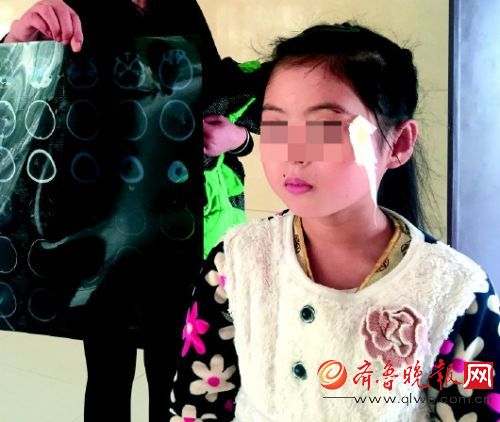 老师丢黑板擦将女生砸破相:本想丢她同桌(图)