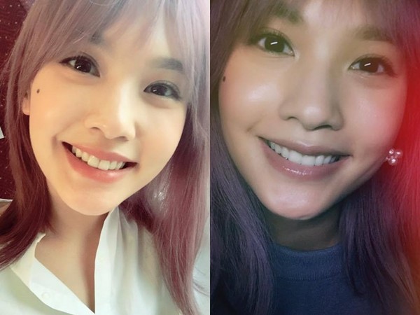 杨丞琳回呛整容传闻:我天然到理直气壮(图)