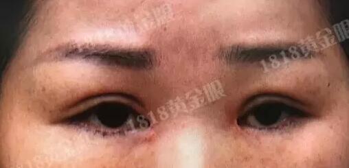 杭州女子做整形后上班遭拒 老板娘:太吓人了(图)