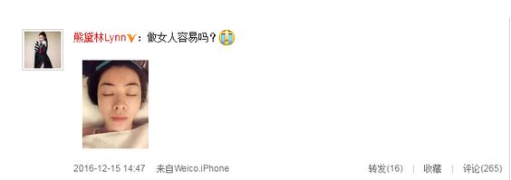 熊黛林满脸扎针,这是什么情况?(组图)