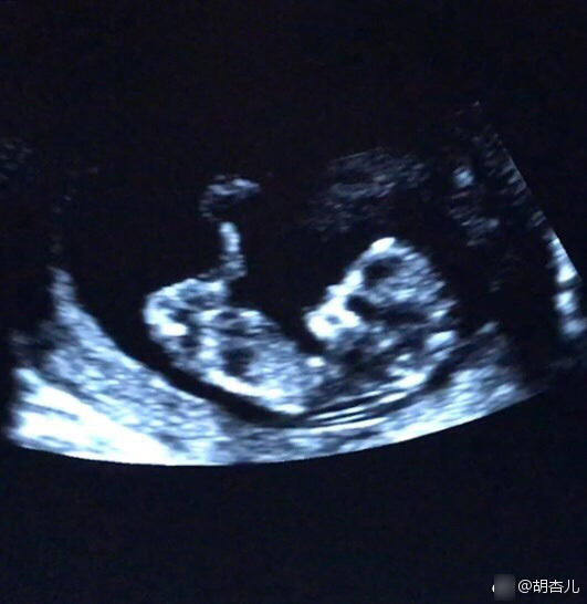 胡杏儿宣布怀孕:宝宝在我肚子里做仰卧起坐(图)