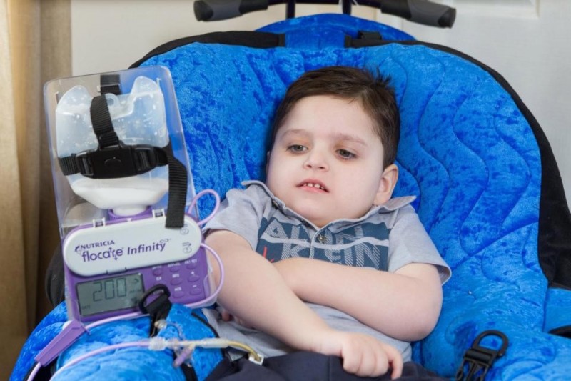 英国男孩患罕见病2年不会笑 全球仅25例(图)